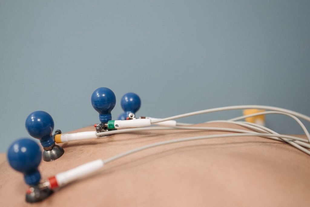 Montre connectée santé 2026 avec ECG et glycémie : notre test et avis honnête